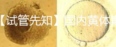 【試管先知】國內(nèi)黃體期方案經(jīng)驗(yàn)緊缺,2點(diǎn)促排弊端需了解