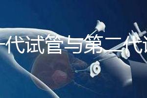 第一代試管與第二代試管有什么區(qū)別？