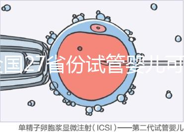 全國27省份試管嬰兒可報銷,這些城市醫(yī)保政策最新匯總