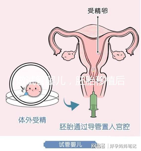 做試管嬰兒，胚胎移植后需要住院嗎？