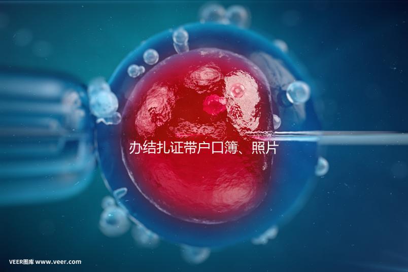 辦結扎證帶戶口簿、照片作用不大，要一樣就足夠~