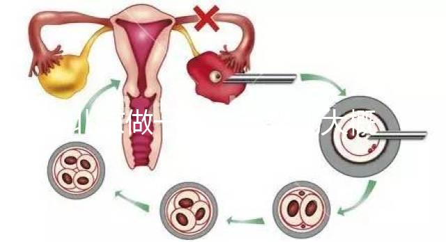 北京做一次試管嬰兒大概花多少錢？2025年價格及明細清單一覽！
