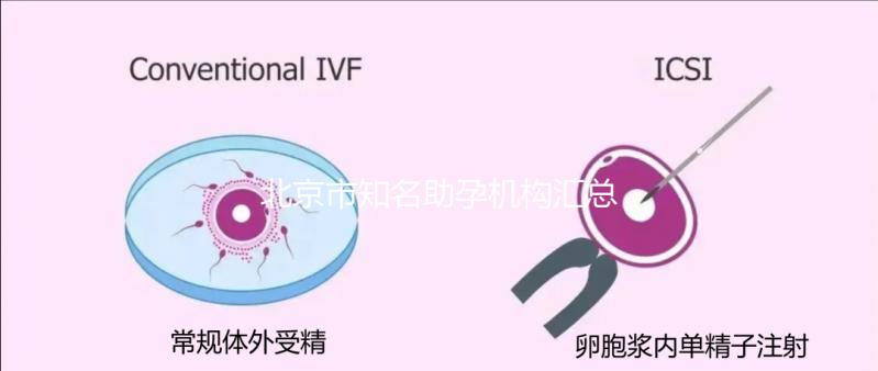 北京市知名助孕機構匯總,成功率多少一看便知!