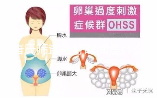 唐氏篩查最好時(shí)間是什么時(shí)候,內(nèi)蒙古單項(xiàng)費(fèi)用不超三百