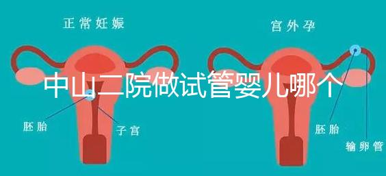 中山二院做試管嬰兒哪個醫生好？附醫院試管成功率