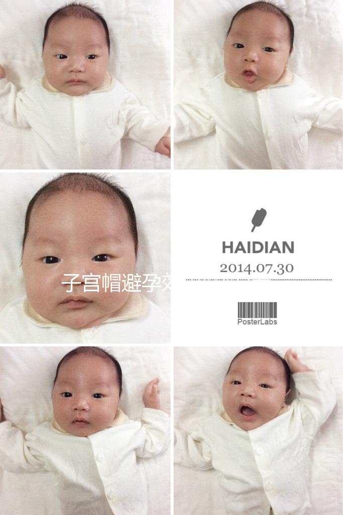 子宮帽避孕效果好嗎?看看網友們有什么經驗之談