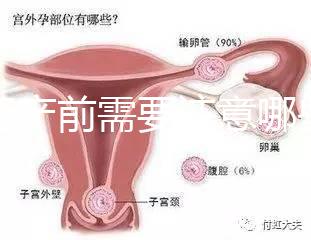 孕婦產(chǎn)前需要注意哪些事項?