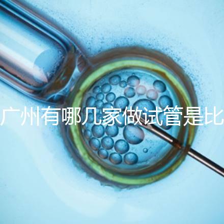 廣州有哪幾家做試管是比較靠譜的，最近有打算？