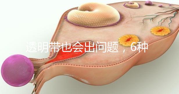 透明帶也會出問題，6種異常類型形成原因不同