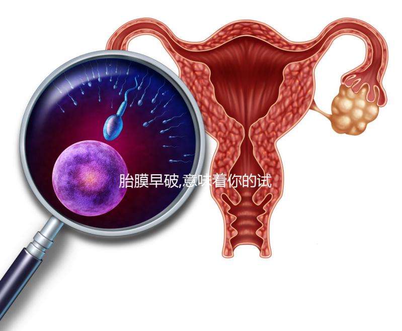 胎膜早破,意味著你的試管嬰兒媽媽夢也破裂了？！