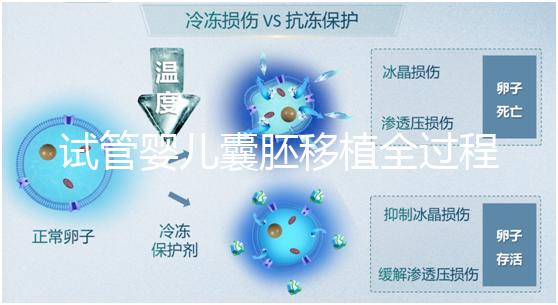 試管嬰兒囊胚移植全過程揭秘