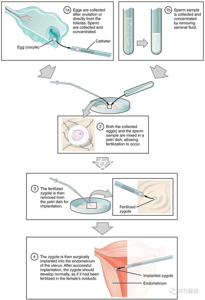 貴陽(yáng)未婚子女戶口如何向婦女介紹，附2024年結(jié)算流程