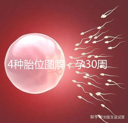 4種胎位圖解，孕30周這個(gè)姿勢(shì)最適合順產(chǎn)