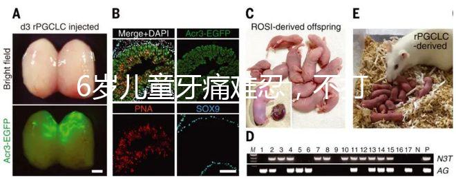 6歲兒童牙痛難忍，不打針吃藥5個小妙招快速止疼